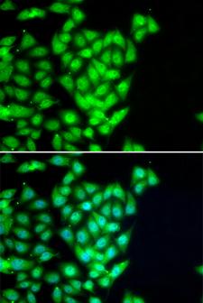 RAD51B Antibody - Immunofluorescence analysis of U20S cells.