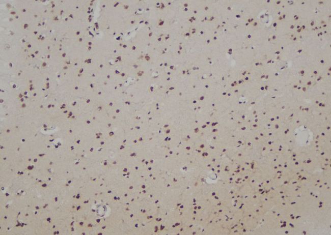 RAD51B Antibody - 1:100 staining human brain tissue by IHC-P. The sample was formaldehyde fixed and a heat mediated antigen retrieval step in citrate buffer was performed. The sample was then blocked and incubated with the antibody for 1.5 hours at 22°C. An HRP conjugated goat anti-rabbit antibody was used as the secondary.