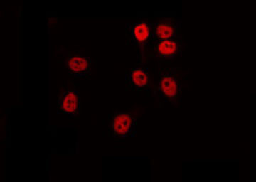 RAD51B Antibody - Staining COS7 cells by IF/ICC. The samples were fixed with PFA and permeabilized in 0.1% Triton X-100, then blocked in 10% serum for 45 min at 25°C. The primary antibody was diluted at 1:200 and incubated with the sample for 1 hour at 37°C. An Alexa Fluor 594 conjugated goat anti-rabbit IgG (H+L) Ab, diluted at 1/600, was used as the secondary antibody.