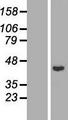 RAD51B Protein - Western validation with an anti-DDK antibody * L: Control HEK293 lysate R: Over-expression lysate