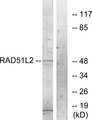 RAD51C Antibody - Western blot analysis of lysates from COS7 cells, using RAD51L2 Antibody. The lane on the right is blocked with the synthesized peptide.