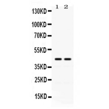 RAD51C Antibody - Rad51C antibody Western blot. All lanes: Anti Rad51C at 0.5 ug/ml. Lane 1: A549 Whole Cell Lysate at 40 ug. Lane 2: COLO320 Whole Cell Lysate at 40 ug. Predicted band size: 42 kD. Observed band size: 42 kD.