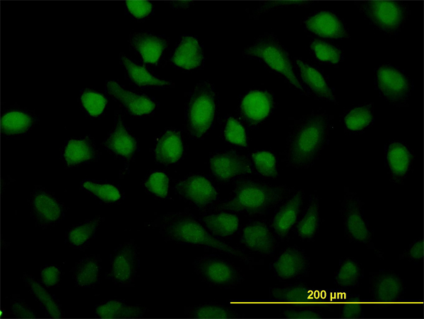 RAD51C Antibody - Immunofluorescence of monoclonal antibody to RAD51C on HeLa cell. [antibody concentration 10 ug/ml]