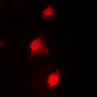 RAD51C Antibody - Immunofluorescent analysis of RAD51C staining in HeLa cells. Formalin-fixed cells were permeabilized with 0.1% Triton X-100 in TBS for 5-10 minutes and blocked with 3% BSA-PBS for 30 minutes at room temperature. Cells were probed with the primary antibody in 3% BSA-PBS and incubated overnight at 4 deg C in a humidified chamber. Cells were washed with PBST and incubated with a DyLight 594-conjugated secondary antibody (red) in PBS at room temperature in the dark. DAPI was used to stain the cell nuclei (blue).