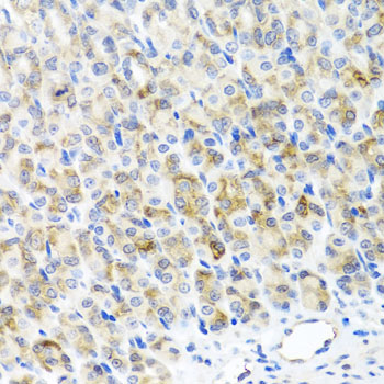 RAD51C Antibody - Immunohistochemistry of paraffin-embedded mouse stomach tissue.