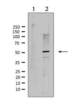 RAD51C Antibody - Western blot analysis of extracts of HeLa cells using RAD51L2 antibody. Lane 1 was treated with the antigen-specific peptide.