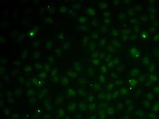 RAD51C Antibody - Immunofluorescence analysis of MCF-7 cells using RAD51C Polyclonal Antibody.