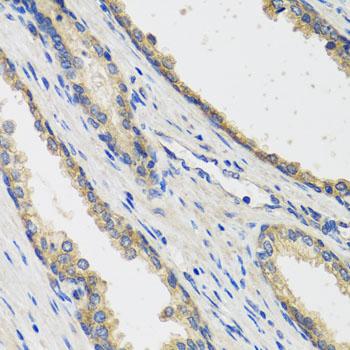 RAD51C Antibody - Immunohistochemistry of paraffin-embedded Human prostate using RAD51C Polyclonal Antibody at dilution of 1:100 (40x lens).