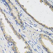 RAD51C Antibody - Immunohistochemistry of paraffin-embedded Human prostate using RAD51C Polyclonal Antibody at dilution of 1:100 (40x lens).