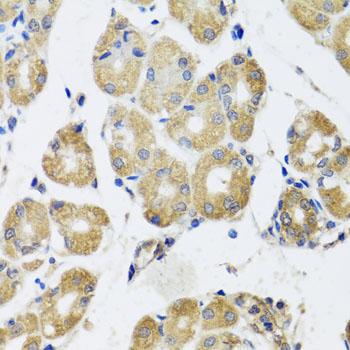 RAD51C Antibody - Immunohistochemistry of paraffin-embedded Human stomach using RAD51C Polyclonal Antibody at dilution of 1:100 (40x lens).