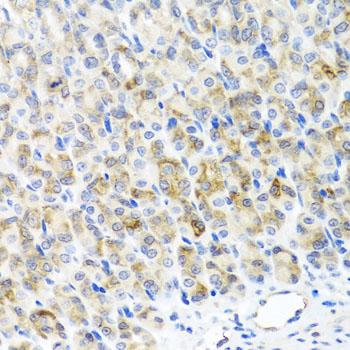RAD51C Antibody - Immunohistochemistry of paraffin-embedded Mouse stomach using RAD51C Polyclonal Antibody at dilution of 1:100 (40x lens).