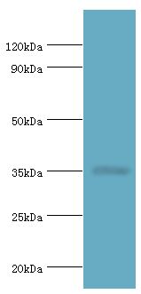 RAD51L3 / RAD51D Antibody - Western blot. All lanes: DNA repair protein RAD51 homolog 4 antibody at 8 ug/ml+Jurkat whole cell lysate. Secondary antibody: Goat polyclonal to rabbit at 1:10000 dilution. Predicted band size: 35 kDa. Observed band size: 35 kDa.