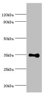 RAD51L3 / RAD51D Antibody - Western blot All lanes: DNA repair protein RAD51 homolog 4 antibody at 8µg/ml + Jurkat whole cell lysate Secondary Goat polyclonal to rabbit IgG at 1/10000 dilution Predicted band size: 36, 6, 24, 31, 13, 23, 38 kDa Observed band size: 36 kDa