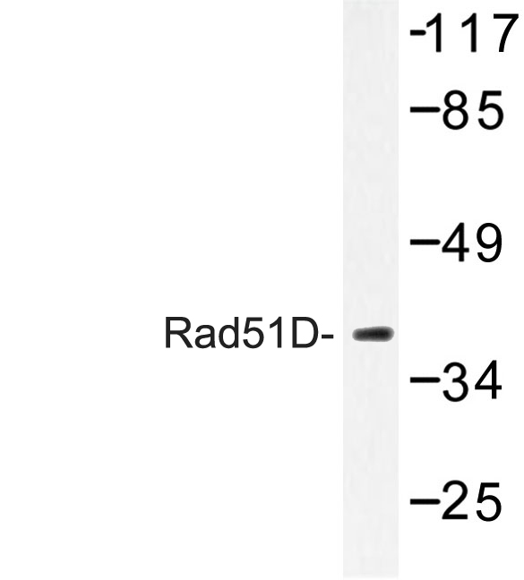 RAD51L3 / RAD51D Antibody - Western blot of Rad51D (A152) pAb in extracts from Jurkat cells.