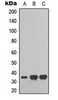 RAD51L3 / RAD51D Antibody - Western blot analysis of RAD51D expression in HepG2 (A); HEK293T (B); HeLa (C) whole cell lysates.