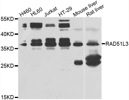 RAD51L3 / RAD51D Antibody - Western blot analysis of extracts of various cells.