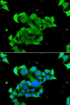 RAD51L3 / RAD51D Antibody - Immunofluorescence analysis of A549 cells.