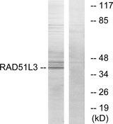 RAD51L3 / RAD51D Antibody - Western blot analysis of extracts from Jurkat cells, using RAD51L3 antibody.