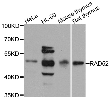 RAD52 Antibody - Western blot analysis of extracts of various cell lines.