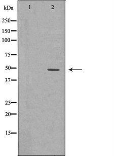 RAD52 Antibody - Western blot analysis of extracts of K562 cells using RAD52 antibody. The lane on the left is treated with the antigen-specific peptide.