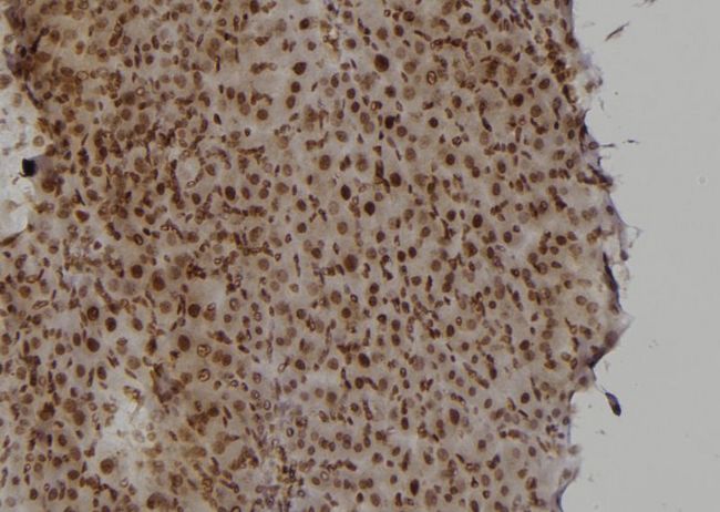 RAD52 Antibody - 1:100 staining rat liver tissue by IHC-P. The sample was formaldehyde fixed and a heat mediated antigen retrieval step in citrate buffer was performed. The sample was then blocked and incubated with the antibody for 1.5 hours at 22°C. An HRP conjugated goat anti-rabbit antibody was used as the secondary.