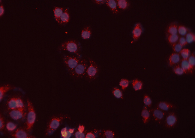 RAD52 Antibody - Staining HeLa cells by IF/ICC. The samples were fixed with PFA and permeabilized in 0.1% Triton X-100, then blocked in 10% serum for 45 min at 25°C. The primary antibody was diluted at 1:200 and incubated with the sample for 1 hour at 37°C. An Alexa Fluor 594 conjugated goat anti-rabbit IgG (H+L) antibody, diluted at 1/600 was used as secondary antibody.