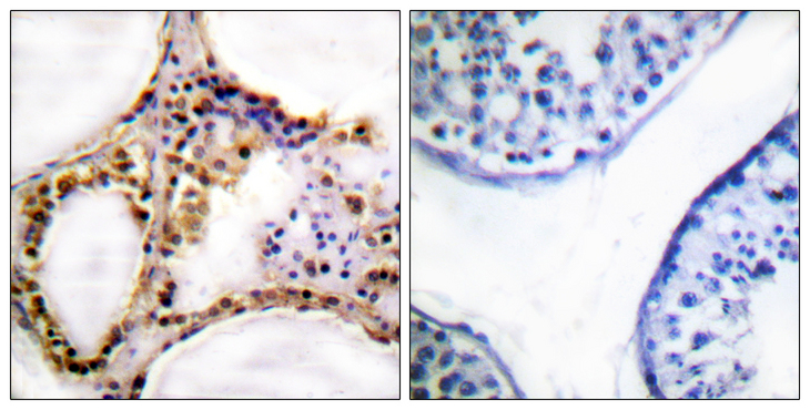 RAD52 Antibody - Immunohistochemistry analysis of paraffin-embedded human testis, using RAD52 (Phospho-Tyr104) Antibody. The picture on the right is blocked with the phospho peptide.