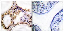 RAD52 Antibody - Immunohistochemistry analysis of paraffin-embedded human testis, using RAD52 (Phospho-Tyr104) Antibody. The picture on the right is blocked with the phospho peptide.
