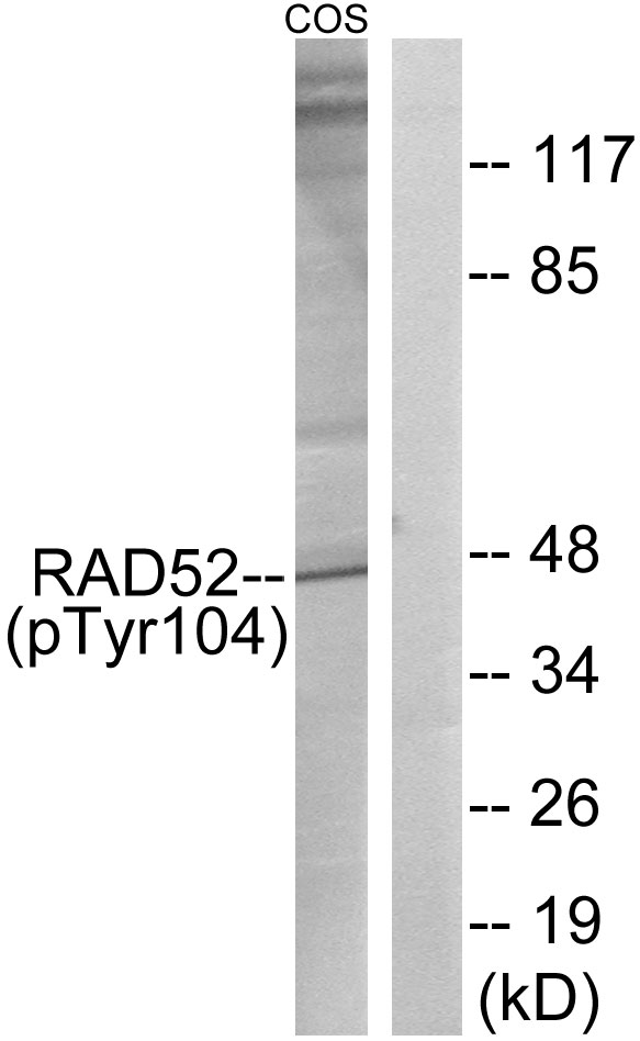 RAD52 Antibody - Western blot analysis of lysates from COS7 cells treated with H2O2 100uM 30', using RAD52 (Phospho-Tyr104) Antibody. The lane on the right is blocked with the phospho peptide.