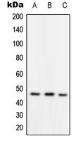 RAD52 Antibody - Western blot analysis of RAD52 (pY104) expression in HepG2 (A); mouse spleen (B); rat spleen (C) whole cell lysates.