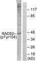 RAD52 Antibody - Western blot analysis of extracts from COS cells, treated with H2O2 (100uM, 30mins), using RAD52 (Phospho-Tyr104) antibody.