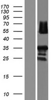 RAD52 Protein - Western validation with an anti-DDK antibody * L: Control HEK293 lysate R: Over-expression lysate