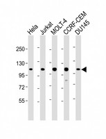 RAD54B Antibody - All lanes: Anti-RAD54B Antibody (N-Term) at 1:2000 dilution. Lane 1: HeLa whole cell lysate. Lane 2: Jurkat whole cell lysate. Lane 3: MOLT-4 whole cell lysate. Lane 4: CCRF-CEM whole cell lysate. Lane 5: DU145 whole cell lysate Lysates/proteins at 20 ug per lane. Secondary Goat Anti-Rabbit IgG, (H+L), Peroxidase conjugated at 1:10000 dilution. Predicted band size: 103 kDa. Blocking/Dilution buffer: 5% NFDM/TBST.