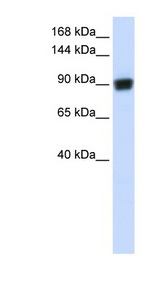 RAD54B Antibody - RAD54B antibody Western blot of Fetal Brain lysate. This image was taken for the unconjugated form of this product. Other forms have not been tested.