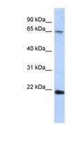 RAD54B Antibody - RAD54B antibody Western blot of HepG2 cell lysate. This image was taken for the unconjugated form of this product. Other forms have not been tested.
