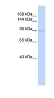 RAD54B Antibody - RAD54B antibody Western blot of HeLa lysate. This image was taken for the unconjugated form of this product. Other forms have not been tested.