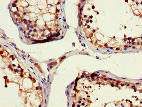 RAD54B Antibody - Immunohistochemistry of paraffin-embedded human testis tissue using RAD54B Antibody at dilution of 1:100