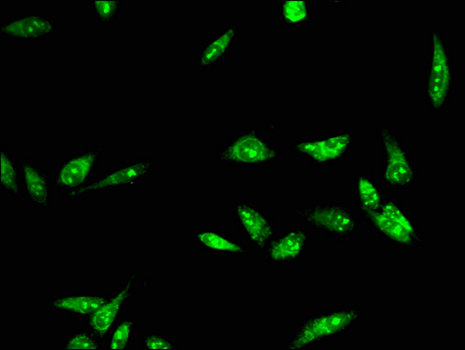 RAD54B Antibody - Immunofluorescent analysis of Hela cells using RAD54B Antibody at a dilution of 1:100 and Alexa Fluor 488-congugated AffiniPure Goat Anti-Rabbit IgG(H+L)