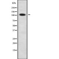 RAD54B Antibody - Western blot analysis of RAD54B using COLO205 whole cells lysates