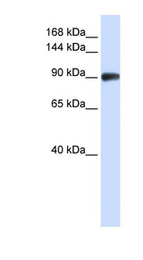 RAD54B Antibody - RAD54B antibody Western blot of Jurkat lysate. This image was taken for the unconjugated form of this product. Other forms have not been tested.