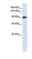 RAD54B Antibody - RAD54B antibody Western blot of Jurkat lysate. This image was taken for the unconjugated form of this product. Other forms have not been tested.