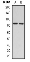 RAD54L Antibody - Western blot analysis of RAD54A expression in Jurkat (A); HEK293T (B) whole cell lysates.
