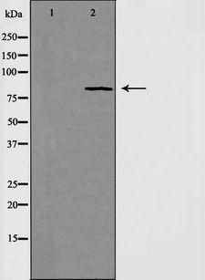 RAD54L Antibody - Western blot analysis of extracts of HeLa cells using RAD54 antibody. The lane on the left is treated with the antigen-specific peptide.