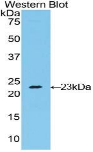 RAD54L2 Antibody - Western blot of recombinant RAD54L2.  This image was taken for the unconjugated form of this product. Other forms have not been tested.