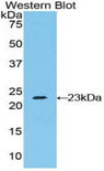 RAD54L2 Antibody - Western blot of recombinant RAD54L2.  This image was taken for the unconjugated form of this product. Other forms have not been tested.