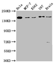 RAD54L2 Antibody - Western Blot Positive WB detected in: Hela whole cell lysate, MCF-7 whole cell lysate, K562 whole cell lysate, U87 whole cell lysate, Rat brain tissue All lanes: RAD54L2 antibody at 3.7µg/ml Secondary Goat polyclonal to rabbit IgG at 1/50000 dilution Predicted band size: 163 kDa Observed band size: 163 kDa