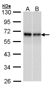 RAD9A / RAD9 Antibody - Sample (30 ug of whole cell lysate). A: A431 , B: Hela. 10% SDS PAGE. RAD9A / RAD9 antibody diluted at 1:1000.