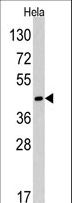 RAD9A / RAD9 Antibody - Western blot of anti-Rad9 Antibody (Center L265) in HeLa cell line lysates (35 ug/lane). Rad9 (arrow) was detected using the purified antibody.