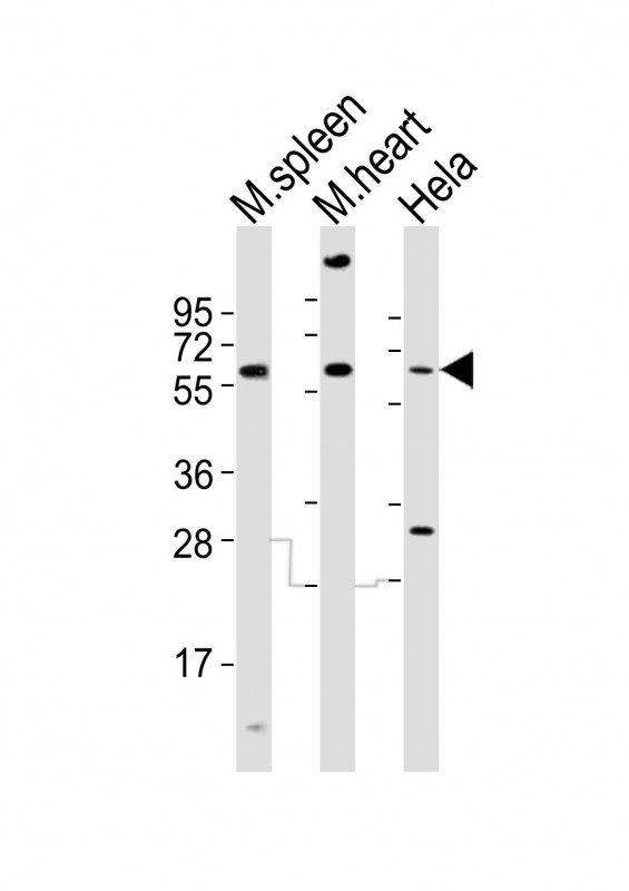 RAD9A / RAD9 Antibody - All lanes : Anti-Rad9a Antibody at 1:2000 dilution Lane 1: mouse spleen lysates Lane 2: mouse heart lysates Lane 3: HeLa whole cell lysates Lysates/proteins at 20 ug per lane. Secondary Goat Anti-Rabbit IgG, (H+L), Peroxidase conjugated at 1/10000 dilution Predicted band size : 42 kDa Blocking/Dilution buffer: 5% NFDM/TBST.