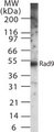 RAD9A / RAD9 Antibody - Western blot of RAD9 using antibody at 2 ug/ml against recombinant RAD9.